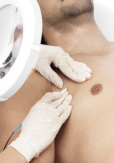 Epilation électrique à Paris | L’AZ de Longchamp